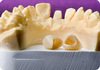 Dental Empress Crown