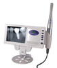 X-ray Film Reader with Intraoral Camera (M-168)