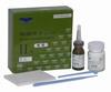 Glass Ionomer Cement (Type II)