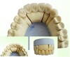 Co-Cr Crown