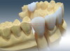 Cercon Zirconium Smart Ceramics System