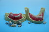 Complication Dental Case