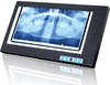 Dental Film Viewer