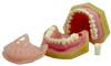Standard Dentition Model C (Removable) 