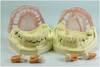 Periodental Disease Model