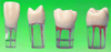 Root Canal Model
