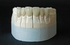 Dental Restorations