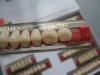 Three Story Color Acrylic Resin Teeth