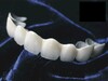 Dental Lab Service