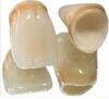 All-Ceramic Materials Teeth
