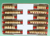 Tooth