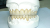 PFM Crown