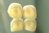 Ceramic Tooth