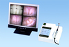 Tabletop Electronic Oral Endoscope (WD-90-TI)
