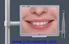 Intra Oral Camera (JH-M602)