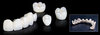 IPS e. Max. ZirCAD