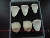 Zirconia All Ceramic Crown