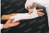 Splint