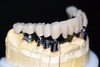 Dental Telescope