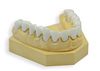 Dental Zirconia Crown