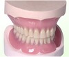 Dental Full Acrylic Denture 
