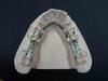 Dental Framework 