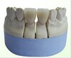 Dental Semi-Precious Pfm Crown 