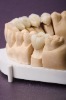 Dental Empress Crown (008)