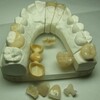Zircon Crowns Brideges