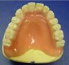 Acrylic Denture