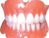 Full Denture (0006)