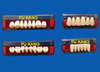 False Teeth