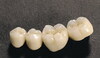 Denture