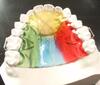 Orthodontic Appliance