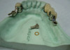 Precision Attachment - 3