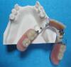 Framework of Resin Teeth (T & MRZ1)