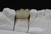 Pfm Crown