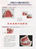 Dental Implant