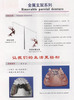 Denture (Metal)