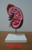 Kidney Model (SMD0649)