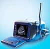 B Mode Ultrasound Sanner (PT6000A)