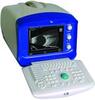 Ultrasonic A-B Scan for Ophthalmology