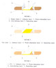 Medical Products - Bandage